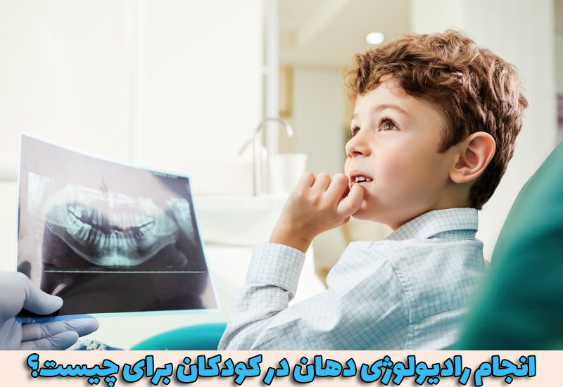 انجام رادیولوژی دهان در کودکان برای چیست؟ 1 انجام رادیولوژی دهان در کودکان برای چیست؟