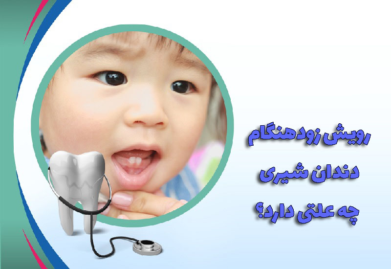 رویش زودهنگام‌ دندان شیری چه علتی دارد؟